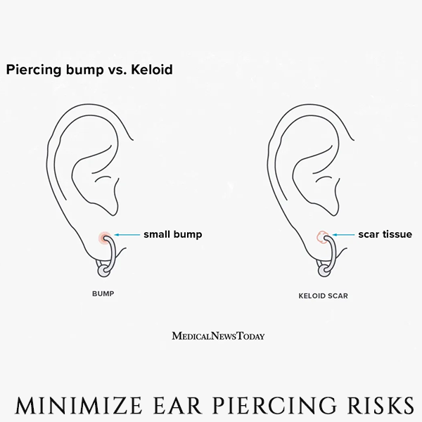 https://develop.grecobarcelona.co.id/storage/photos/1/MINIMIZE EAR PIERCING RISK.png